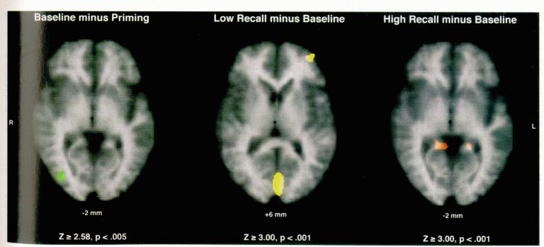 PET Study of Memory Schacter et al., 1996 Baseline minus Priming: decreased blood flow in extrastriate visual areas.