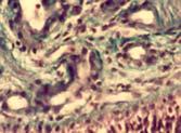 Stem cells Hippocampus 11