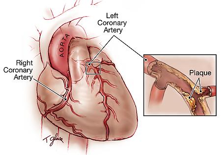 Large Artery