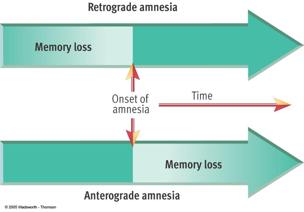 Anterograde Amnesia Damage to hippocampus