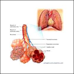 Our treatments for respiratory disorders include bronchial asthma, sinusitis,