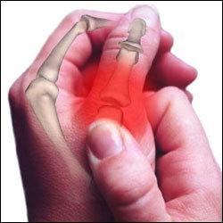 Arthritis Disorder Treatment: We are instrumental in offering