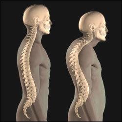 disorders, which are one of the most serious bone ailments.