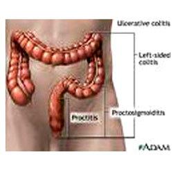 Digestive Disorder Treatment: We are experts in conducting clinically proven and safe treatments for digestive
