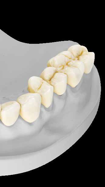Polychromatic Multidiscs for impressive esthetic results Low wall thickness for minimally invasive restorations LS 2 or ZrO 2 bridge ** Typical mean value