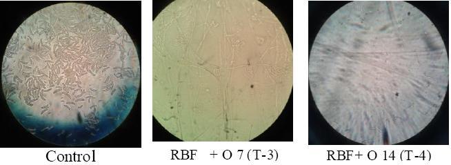 Delgermaa B et al. According to microscopic fungus, spores of Fuzarium spp are detected in control and variant of spaying Oligochitosan in every 7 days on tomato plant.