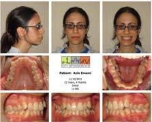 RFMNT  Dentistry Using Orthodontics Final Start