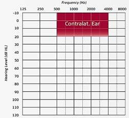 conduction thresholds in the contralateral ear should be equal to or better than the shaded area in the