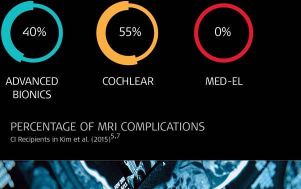 complications. MRI Scans With MED-EL SYNCHRONY Plan MRI. Perform the MRI scan.