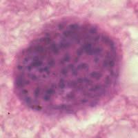 Toxoplasma gondii Toxoplasma gondii cyst in