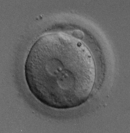 embryo Nucleoli Zona