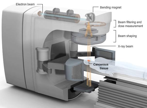Photon radiotherapy Modern