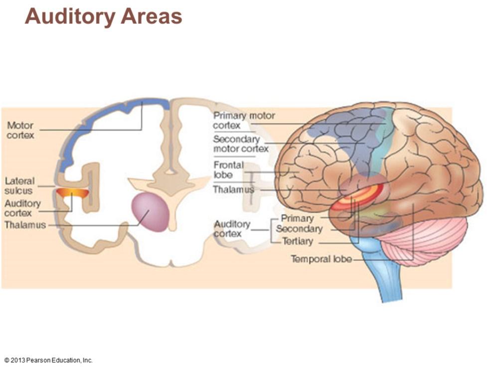 Primary auditory cortex Superior margin of temporal lobes