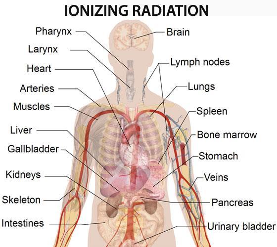 5. Effects of Radiation exposure to human health. High doses of ionizing radiation can lead to various effects, such as skin burns, hair loss, birth defects, illness, cancer, and death.