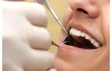 $500+? Typical dental costs: The charge for a standard teeth cleaning and dental exam ranges from $50 -$135.