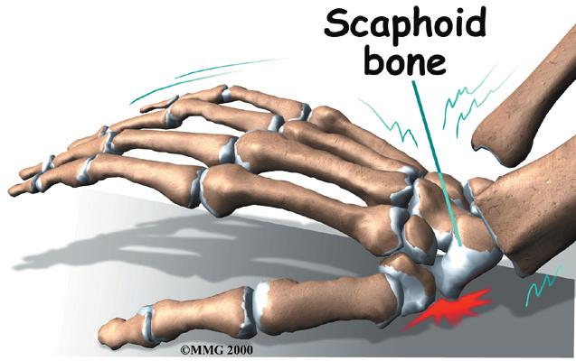 One reason that the wrist is so complicated is because every small bone forms a joint with the bone next to it. This means that what we call the wrist joint is actually made up of many small joints.