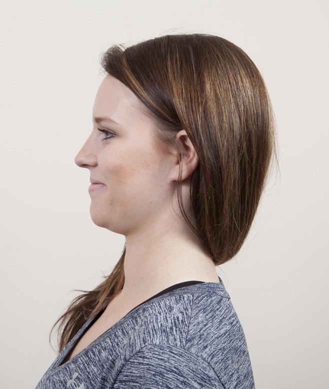 Do not tilt your chin or bend your forehead forward. Push your hands down on your thighs to help straighten your back.