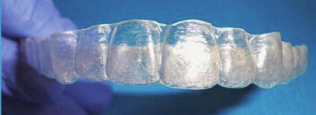 I have my patients rotate the 4 Vivera retainers on a quarterly basis so that all of the retainers are stretched equally.