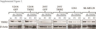Supplementary Figure 1 Cell line TRIB2 status. TRIB2 protein expression to determine endogenous expression and to determine the effectiveness of each of our TRIB2 knockdown constructs.