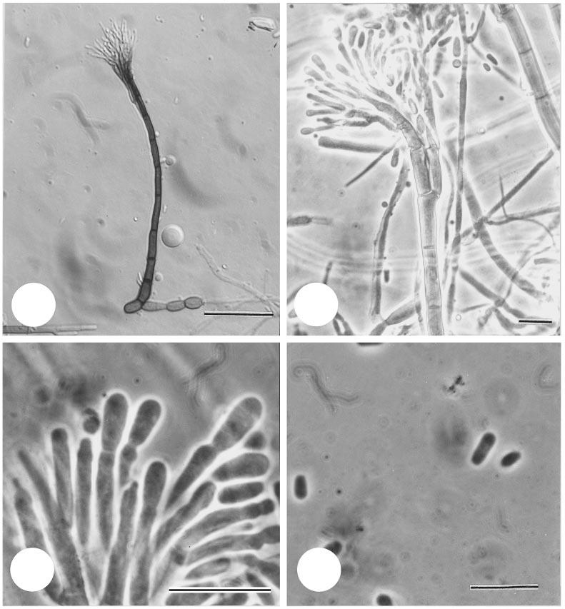 Synonyms of O. piceaperdum 240 1 2 3 4 Figs 1 4. Light micrographs of the conidiophore and conidia of L. piceaperdum (CMW 660) (Bars 10 µm). Fig. 1. Conidiophore. Fig. 2. Conidiogenous apparatus. Fig. 3. Conidiogenous cells.