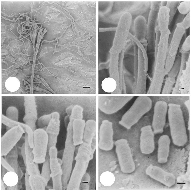 K. Jacobs, M. J. Wingfield and P. W. Crous 241 5 6 7 8 Figs 5 8. SEM of a conidiophore and conidia of L. piceaperdum (CMW 660). Fig. 5. Conidiophore (Bar 10 µm). Figs 6, 7.