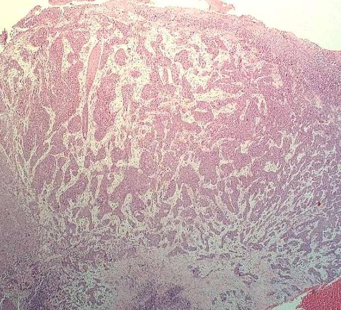 BSD 2015 Case 19 mixed tumour of skin differential