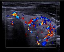 performing dynamic scans of joints in motion, such as this shoulder.