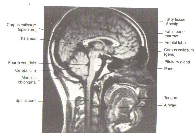 Cerebellum Anatomy and