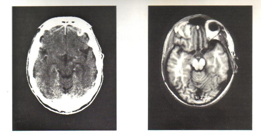 Neuroanatomy, an atlas