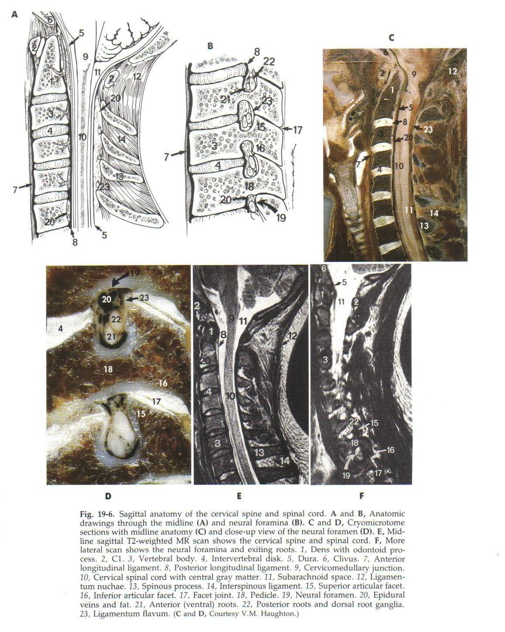 Spine Anatomy and MR Saggital View