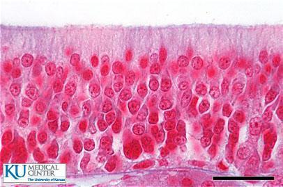 STRATIFIED COLUMNAR EPITHELIUM Consists of more than one layer of epithelial cells Only the surface cells are columnar Deeper