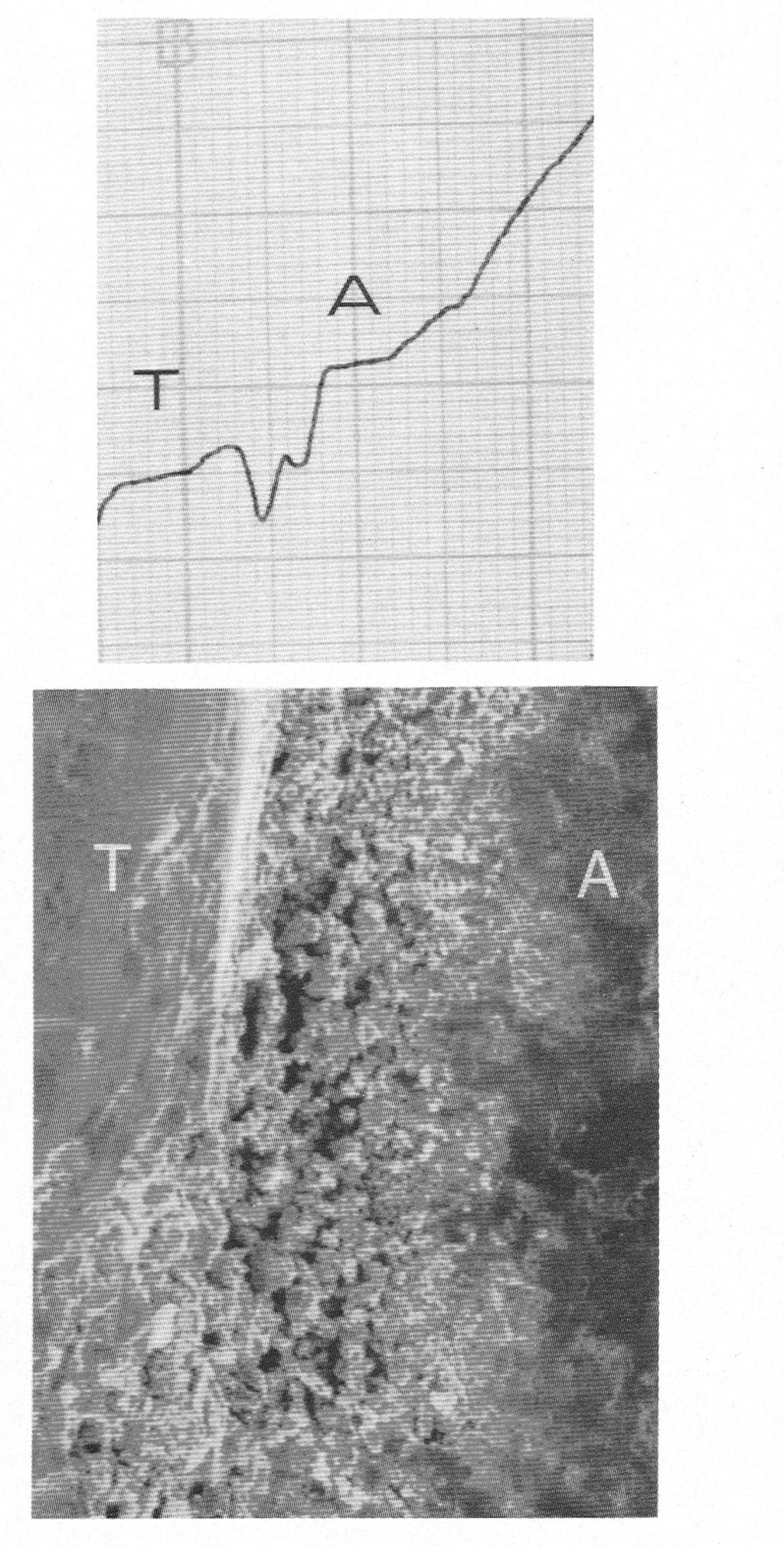 Bottom: Scanning photomicrograph of the same toothamalgam interface left by the chisel (Original magnification, x Top: Individual profilometric tracing after the use