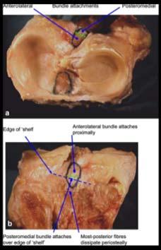 PCL Anatomy Tibia Amis et al.