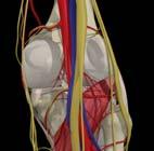 Operative Treatment Inidcations o Acute PCL bony avulsion o Multi-ligament knee injury o Failed conservative treatment Controversies o Tibial inlay vs