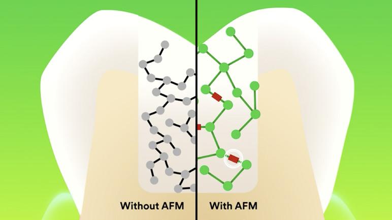 Low polymerization stress allows placement of up to 5 mm Reduces the amount of material shrinkage in the tooth Adequate polymerization is key Past vs.