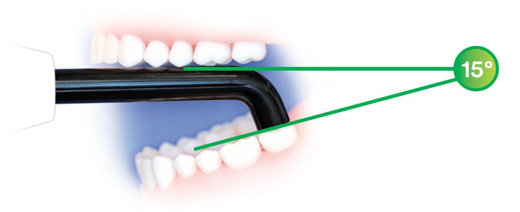 Other Factors Affecting Bulk Fill Restorations Curing Lights Successful restorations require proper light curing Two main factors affecting cure: overall technique and the curing light itself If a