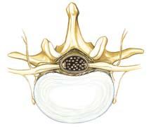The vertebral disc consists of an outer fibrous ring and a central pulp.