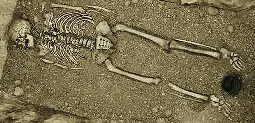 A new report claims to have detected the CCR5-Δ32 mutant allele in four of seventeen Bronze Age skeletons dating to about 900 BC from a burial site in central Germany.