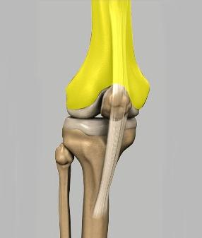 Articular cartilage is the smooth surfaces at the end of the femur and tibia. It is the damage to this surface that causes arthritis.