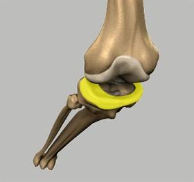 6) Menisci: The medial and the lateral meniscus are thin C-shaped layers of fibrocartilage, incompletely covering the surface of the tibia where it articulates with the femur.
