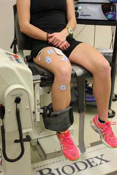 Quadriceps Strength Early measures predict later Presurgical Early rehab Better