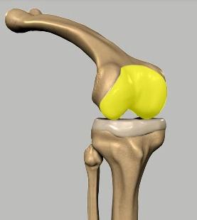 Femur Condyle Tibia Fibula Patella Menisci Femur: The femur (thighbone) is the largest and the strongest bone in the body.
