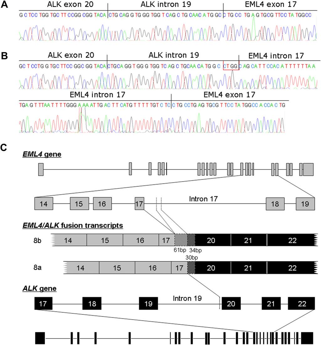 EML4-ALK detection in NSCLC 49 Figure 2 Sequencing of transcript fusion sites in novel EML4eALK fusion variants 8a and 8b with electropherograms from reverse sequencing reactions (A,B) and with