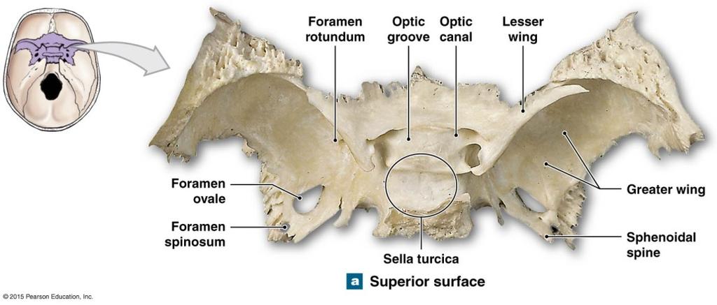 Skull Cranial Bones-Sphenoid Sella turcica Lesser wing Greater wing Horizontal section Sphenoid (1): Forms the floor of the
