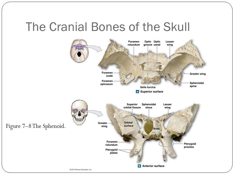 Skull Cranial Bones-Sphenoid a) Foramen ovale-jaws (slide 23) b) Foramen spinosum-cranial cavity membranes (slide 23) c) Foramen