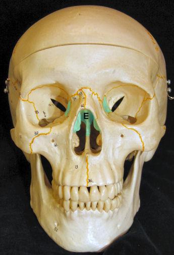 Skull Cranial Bones-Ethmoid Middle nasal concha Ethmoid (1): Perpendicular