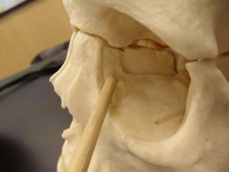 Lacrimal Lateral view Skull Facial Bones-Lacrimal s Lacrimal s (2): Smallest facial. Resembles a fingernail.