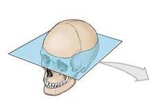 Skull Cranial Bones Horizontal