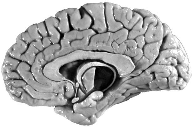 cingulate gyrus Limbic lobe: C-shape border of hemisphere