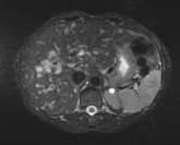 image at any time Quantitative imaging Tumor treatment response assessment